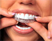 ProSnore ADJUSTABLE ORAL APPLIANCE